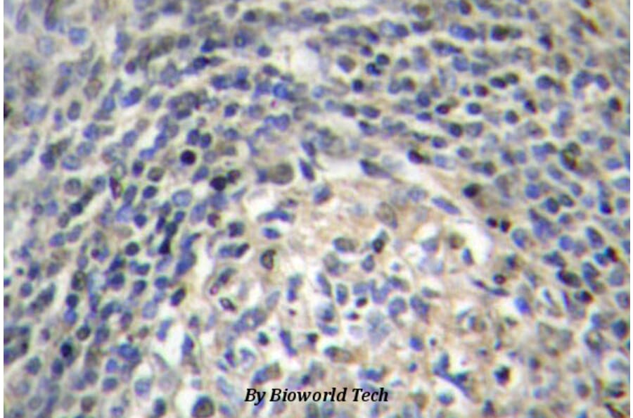Anti-p47-phox (P366) Antibody from Bioworld Technology (BS3261) - Antibodies.com