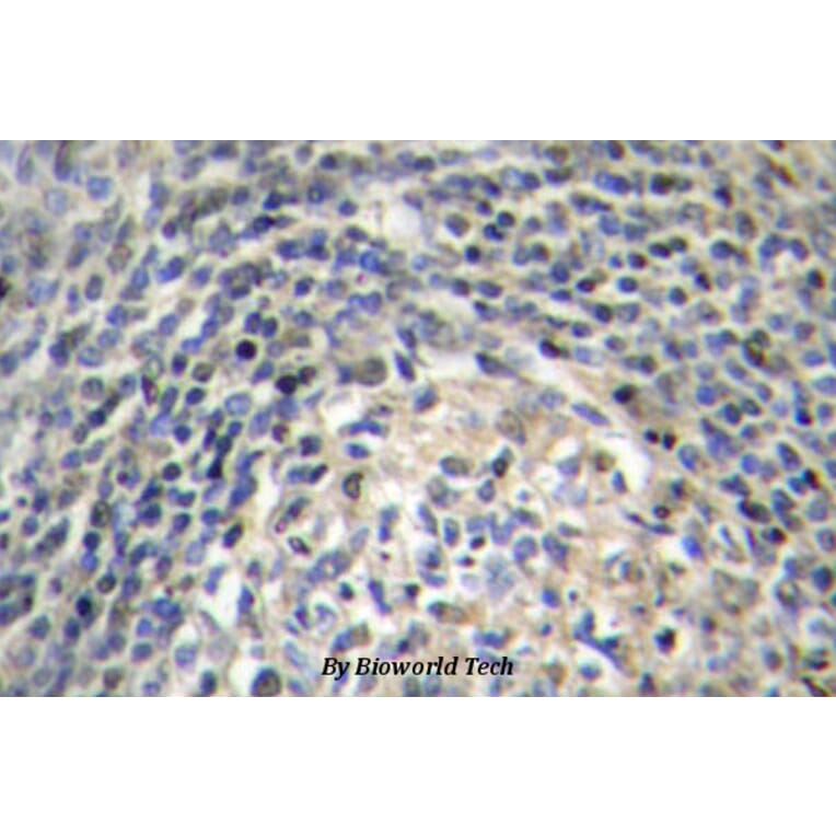 Anti-p47-phox (P366) Antibody from Bioworld Technology (BS3261) - Antibodies.com