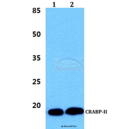 Anti-CRABP-II (P81) Antibody from Bioworld Technology (BS3279) - Antibodies.com