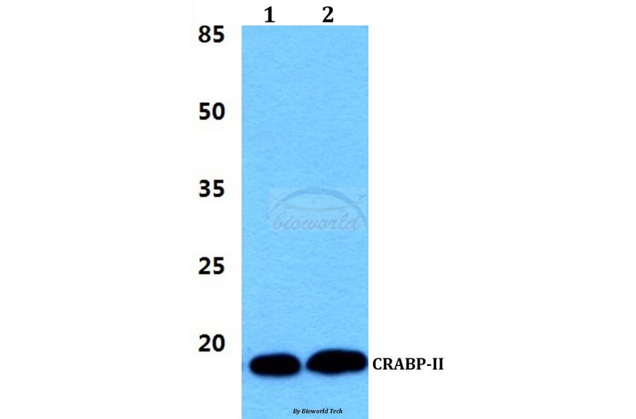 Anti-CRABP-II (P81) Antibody from Bioworld Technology (BS3279) - Antibodies.com