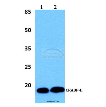 Anti-CRABP-II (P81) Antibody from Bioworld Technology (BS3279) - Antibodies.com