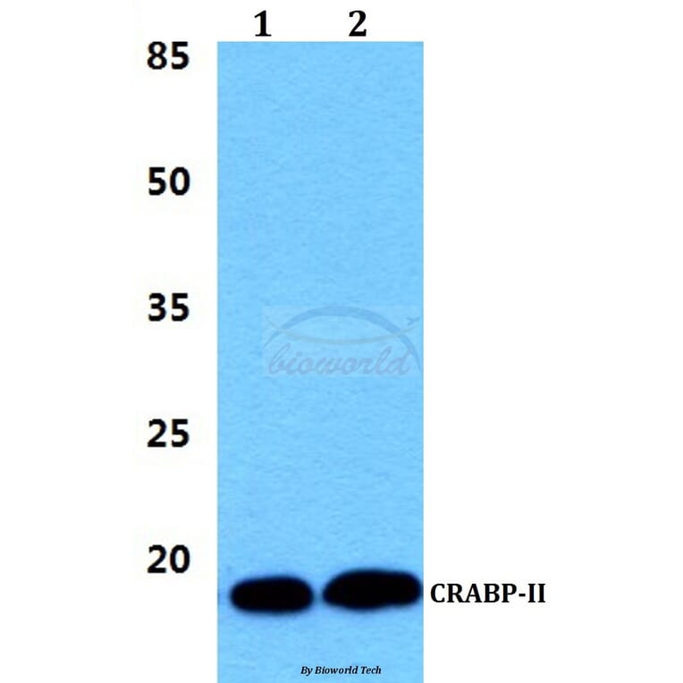 Anti-CRABP-II (P81) Antibody from Bioworld Technology (BS3279) - Antibodies.com