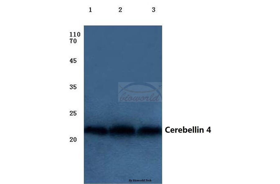 Anti-Cerebellin 4 (K178) Antibody from Bioworld Technology (BS3282) - Antibodies.com