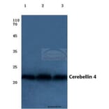 Anti-Cerebellin 4 (K178) Antibody from Bioworld Technology (BS3282) - Antibodies.com
