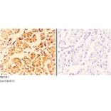 Anti-COP ζ1 (I48) Antibody from Bioworld Technology (BS3287) - Antibodies.com