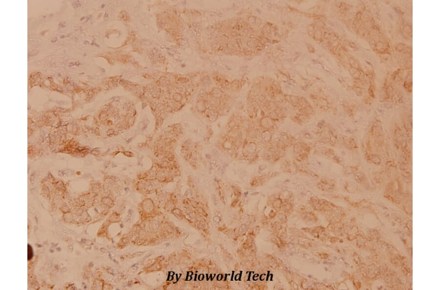 Anti-POLR3A (P68) Antibody from Bioworld Technology (BS3292) - Antibodies.com