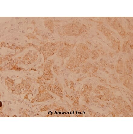 Anti-POLR3A (P68) Antibody from Bioworld Technology (BS3292) - Antibodies.com