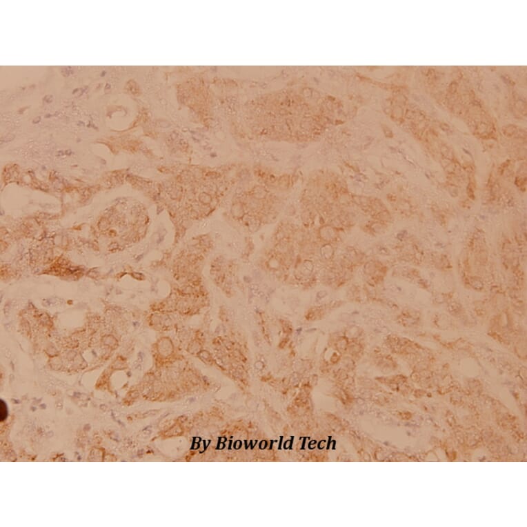 Anti-POLR3A (P68) Antibody from Bioworld Technology (BS3292) - Antibodies.com