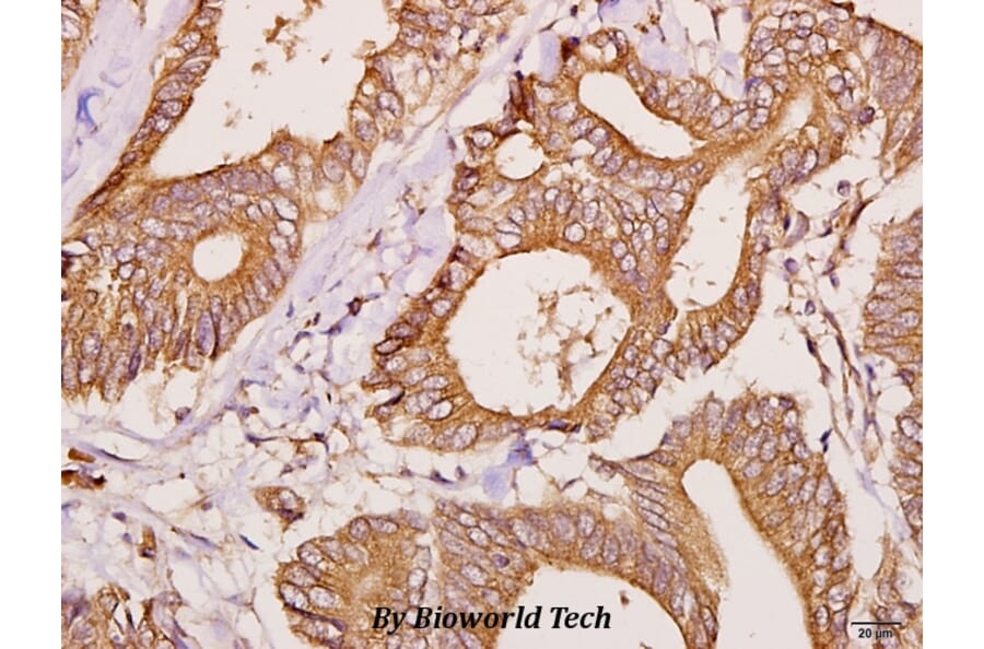 Anti-FBP3 (R241) Antibody from Bioworld Technology (BS3297) - Antibodies.com