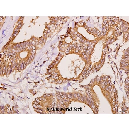 Anti-FBP3 (R241) Antibody from Bioworld Technology (BS3297) - Antibodies.com