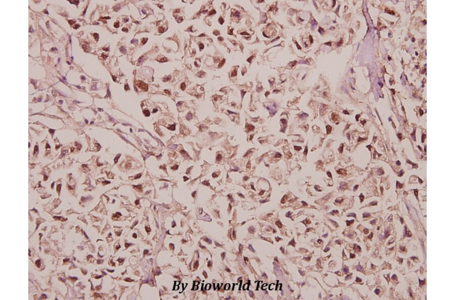 Anti-GABAA Rγ1 (K51) Antibody from Bioworld Technology (BS3301) - Antibodies.com