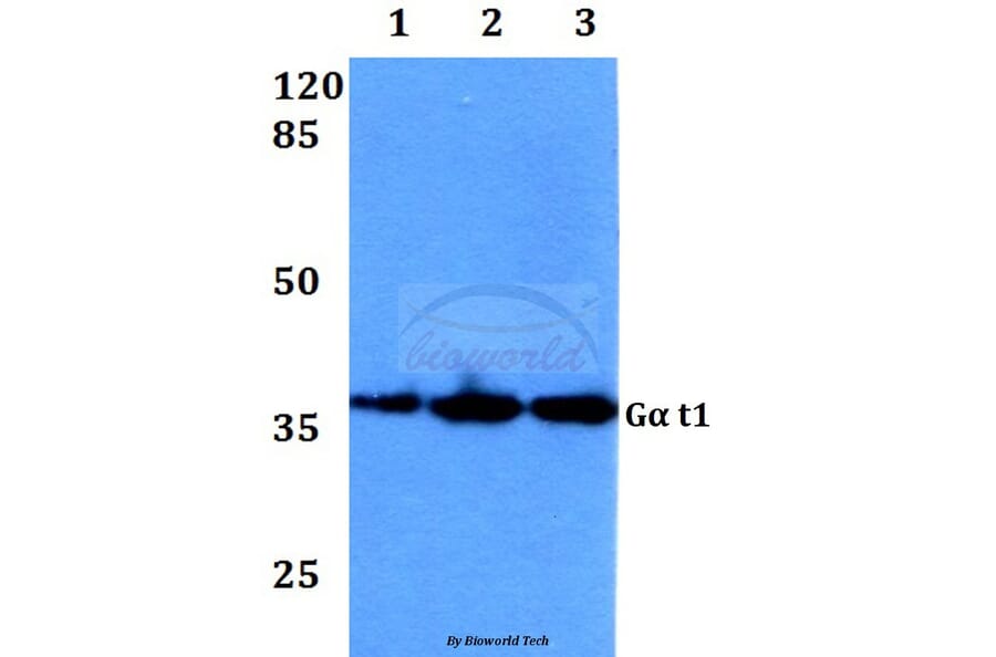 Anti-Gα t1 (M104) Antibody from Bioworld Technology (BS3311) - Antibodies.com