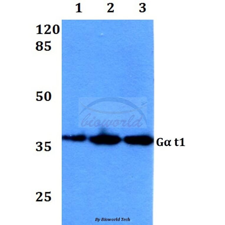Anti-Gα t1 (M104) Antibody from Bioworld Technology (BS3311) - Antibodies.com