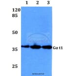 Anti-Gα t1 (M104) Antibody from Bioworld Technology (BS3311) - Antibodies.com
