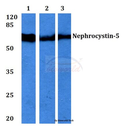 Anti-Nephrocystin-5 (R467) Antibody from Bioworld Technology (BS3319) - Antibodies.com