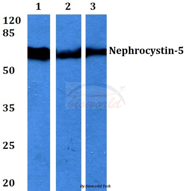 Anti-Nephrocystin-5 (R467) Antibody from Bioworld Technology (BS3319) - Antibodies.com