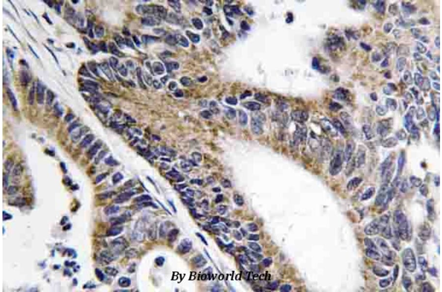 Anti-Nephrocystin-5 (R467) Antibody from Bioworld Technology (BS3319) - Antibodies.com