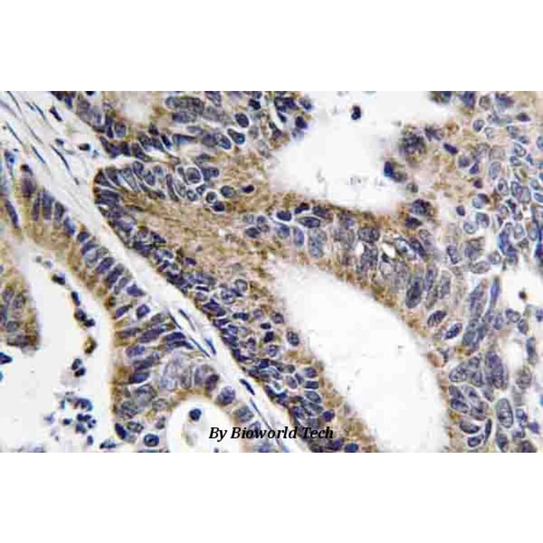 Anti-Nephrocystin-5 (R467) Antibody from Bioworld Technology (BS3319) - Antibodies.com