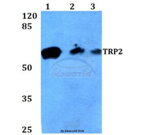 Anti-TRP2 (K89) Antibody from Bioworld Technology (BS3320) - Antibodies.com