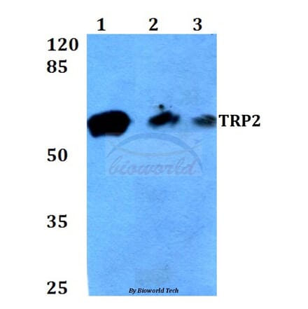 Anti-TRP2 (K89) Antibody from Bioworld Technology (BS3320) - Antibodies.com