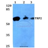 Anti-TRP2 (K89) Antibody from Bioworld Technology (BS3320) - Antibodies.com