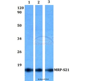 Anti-MRP-S21 (Q85) Antibody from Bioworld Technology (BS3324) - Antibodies.com