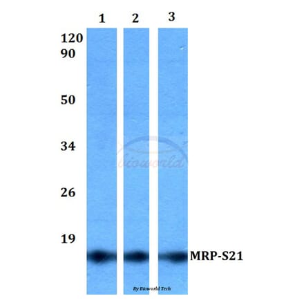 Anti-MRP-S21 (Q85) Antibody from Bioworld Technology (BS3324) - Antibodies.com