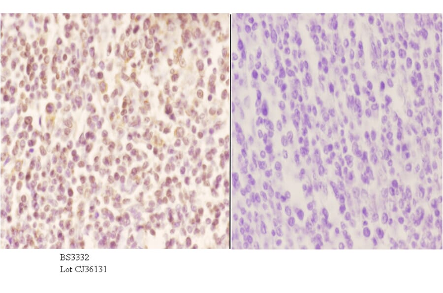 Anti-MNDA (V406) Antibody from Bioworld Technology (BS3332) - Antibodies.com
