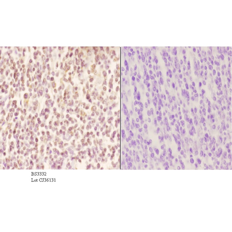 Anti-MNDA (V406) Antibody from Bioworld Technology (BS3332) - Antibodies.com
