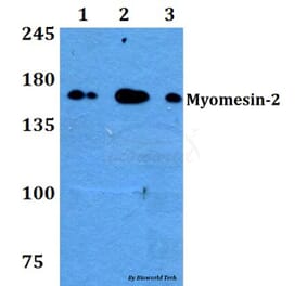 Anti-Myomesin-2 (Y644) Antibody from Bioworld Technology (BS3333) - Antibodies.com