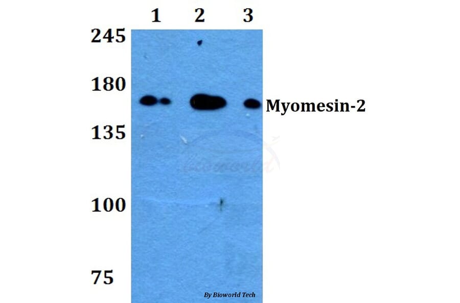 Anti-Myomesin-2 (Y644) Antibody from Bioworld Technology (BS3333) - Antibodies.com