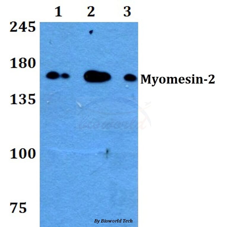 Anti-Myomesin-2 (Y644) Antibody from Bioworld Technology (BS3333) - Antibodies.com