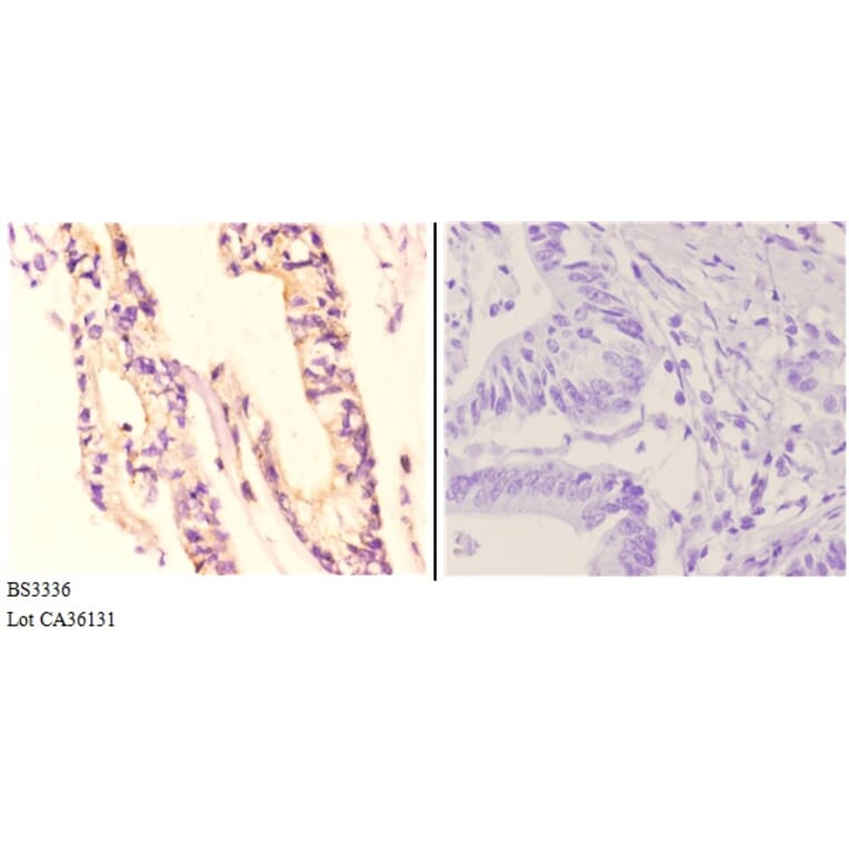 Anti-NDUFA8 (P141) Antibody from Bioworld Technology (BS3336) - Antibodies.com