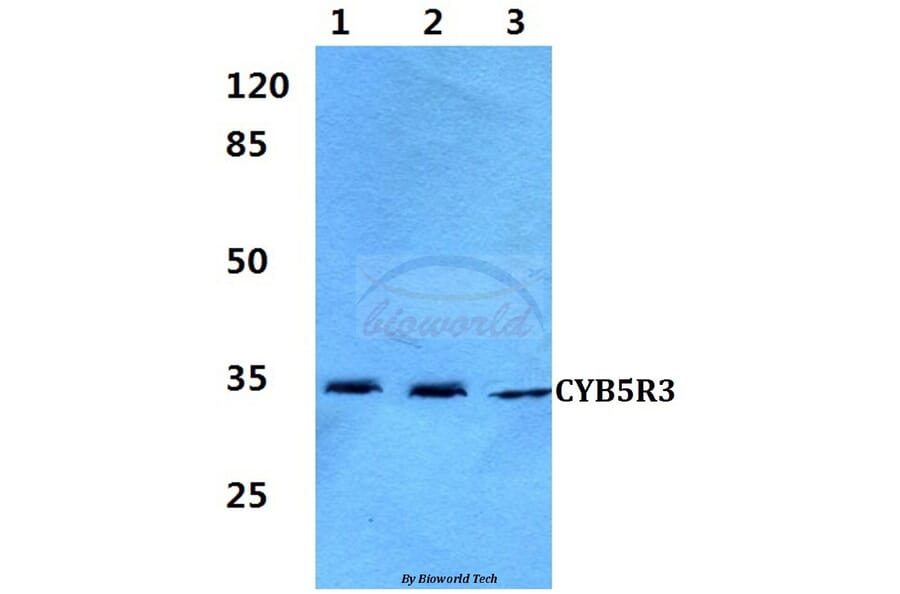 Anti-CYB5R3 (I169) Antibody from Bioworld Technology (BS3337) - Antibodies.com