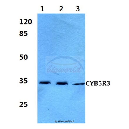 Anti-CYB5R3 (I169) Antibody from Bioworld Technology (BS3337) - Antibodies.com