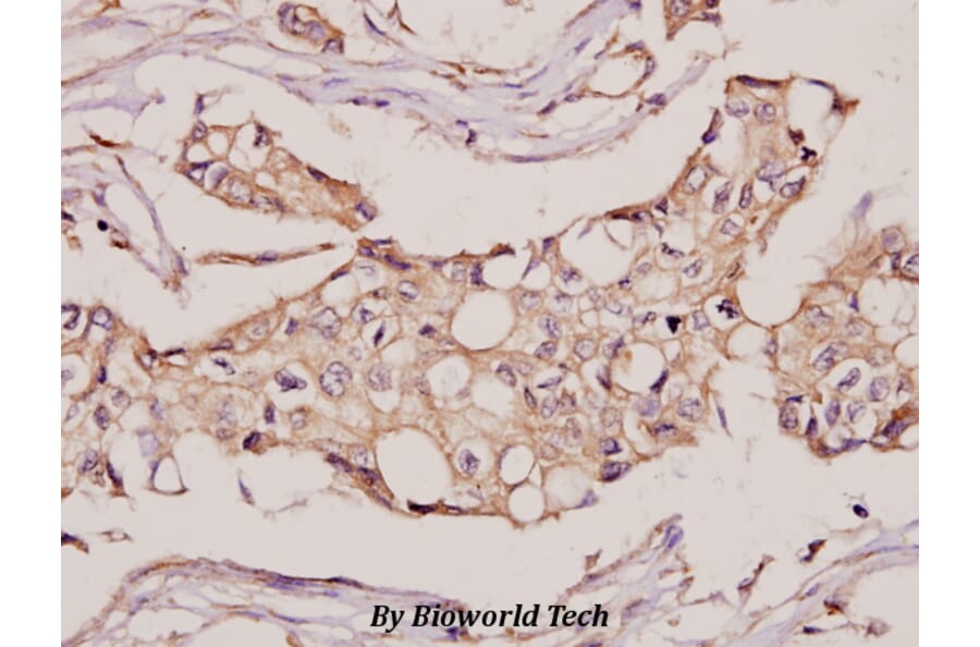 Anti-CYB5R3 (I169) Antibody from Bioworld Technology (BS3337) - Antibodies.com