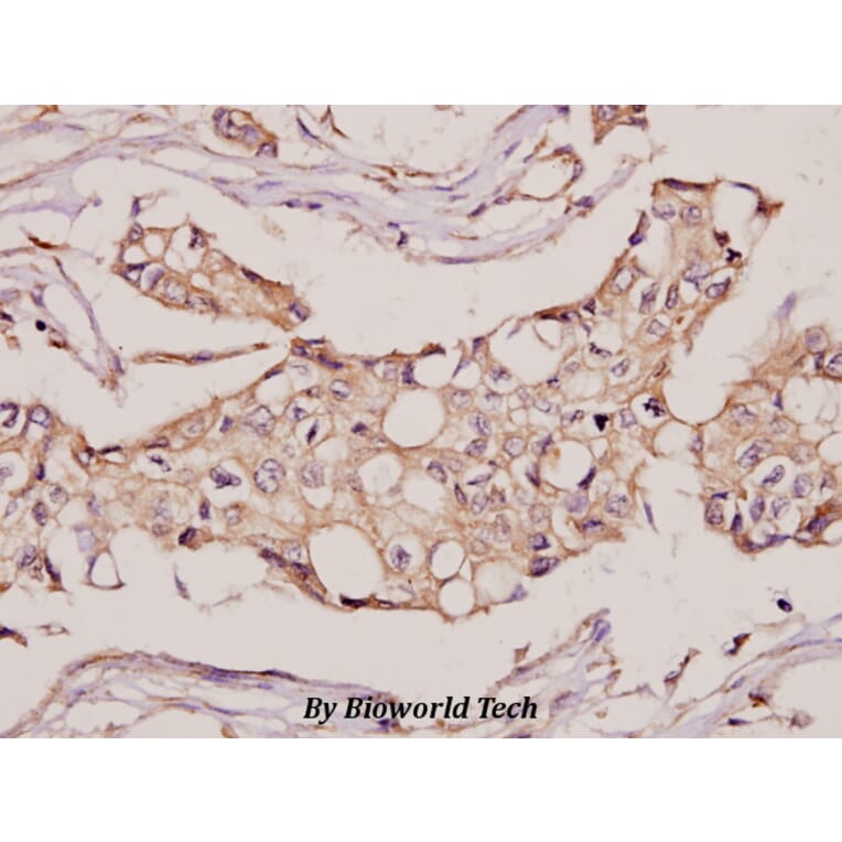 Anti-CYB5R3 (I169) Antibody from Bioworld Technology (BS3337) - Antibodies.com