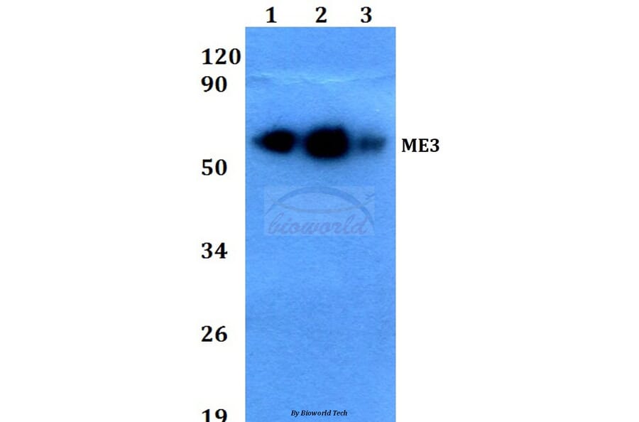 Anti-ME3 (R576) Antibody from Bioworld Technology (BS3339) - Antibodies.com