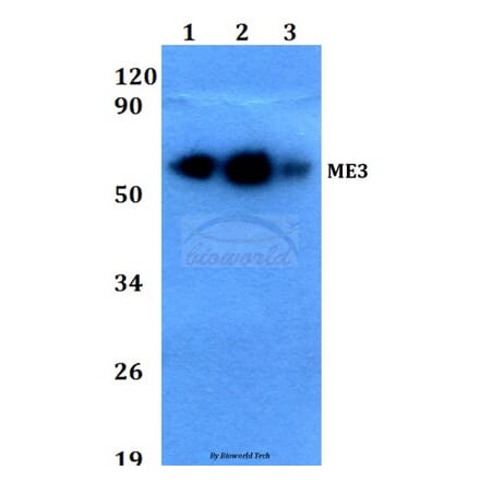 Anti-ME3 (R576) Antibody from Bioworld Technology (BS3339) - Antibodies.com