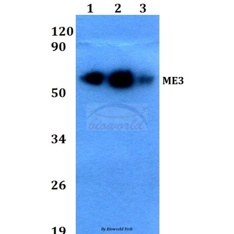 Anti-ME3 (R576) Antibody from Bioworld Technology (BS3339) - Antibodies.com