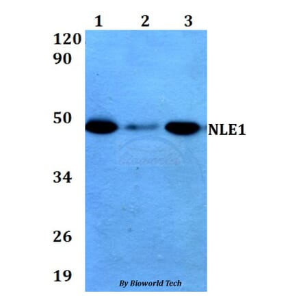 Anti-NLE1 (Y333) Antibody from Bioworld Technology (BS3353) - Antibodies.com