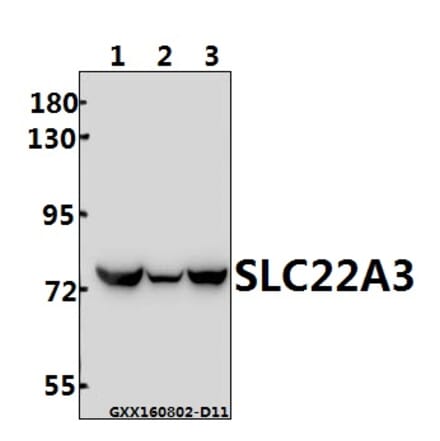 Anti-SLC22A3 (Q306) Antibody from Bioworld Technology (BS3359) - Antibodies.com