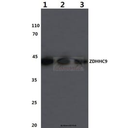 Anti-ZDHHC9 (K364) Antibody from Bioworld Technology (BS3363) - Antibodies.com