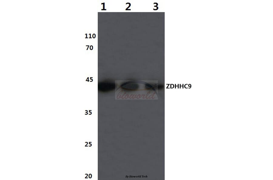 Anti-ZDHHC9 (K364) Antibody from Bioworld Technology (BS3363) - Antibodies.com