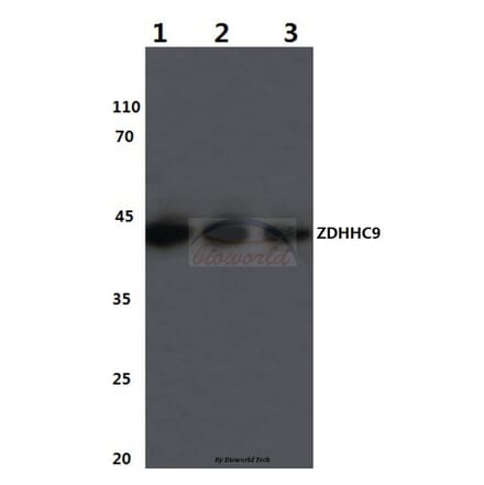 Anti-ZDHHC9 (K364) Antibody from Bioworld Technology (BS3363) - Antibodies.com