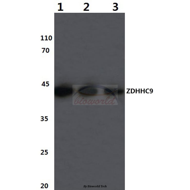 Anti-ZDHHC9 (K364) Antibody from Bioworld Technology (BS3363) - Antibodies.com