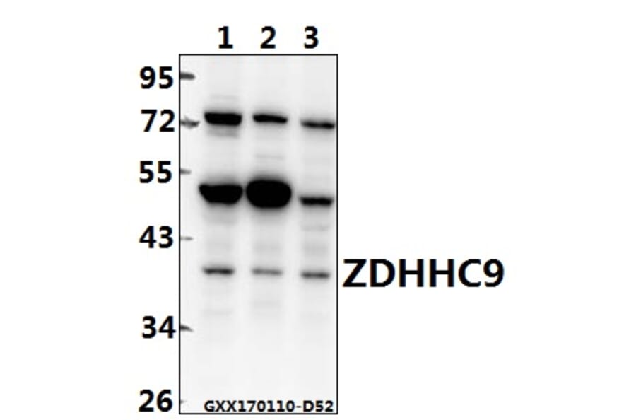 Anti-ZDHHC9 (K364) Antibody from Bioworld Technology (BS3363) - Antibodies.com