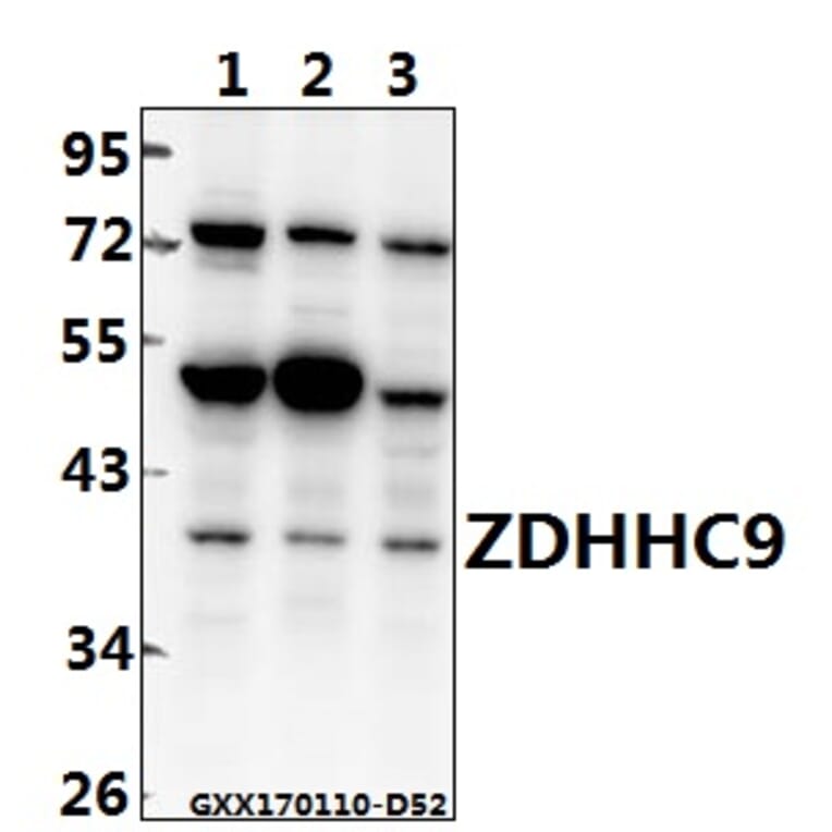 Anti-ZDHHC9 (K364) Antibody from Bioworld Technology (BS3363) - Antibodies.com