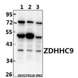 Anti-ZDHHC9 (K364) Antibody from Bioworld Technology (BS3363) - Antibodies.com