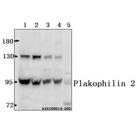 Anti-Plakophilin 2 (P663) Antibody from Bioworld Technology (BS3368) - Antibodies.com